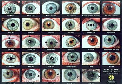 iridology